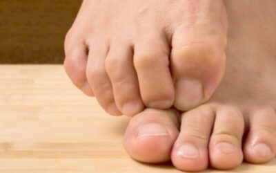 Hongos en los Pies: ¿Por Qué Aparecen y Cómo Combatirlos Efectivamente?